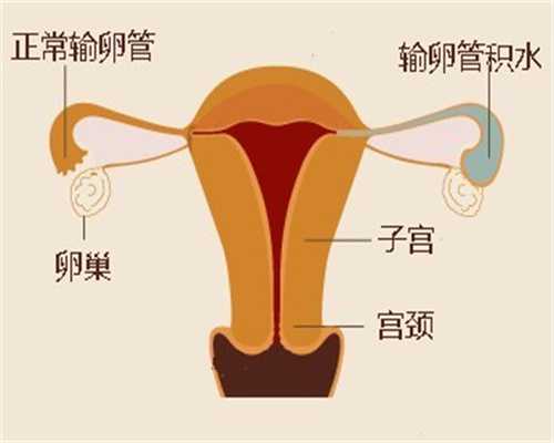 重庆做第三代试管婴儿费用多少钱哪些地方需要花钱